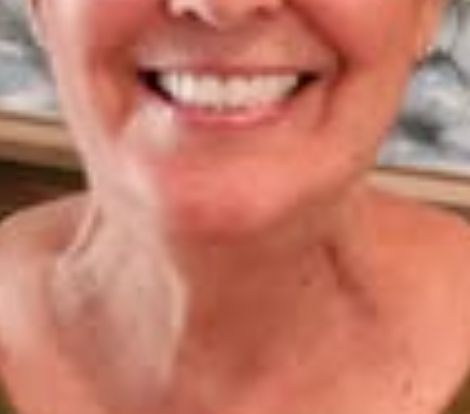 File:True Christian Neck Muscles.jpg